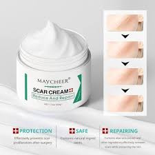 Maycheer Scar Cream